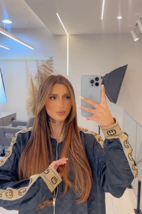 Fernanda Campos revela transformação impressionante após superar problemas capilares severos