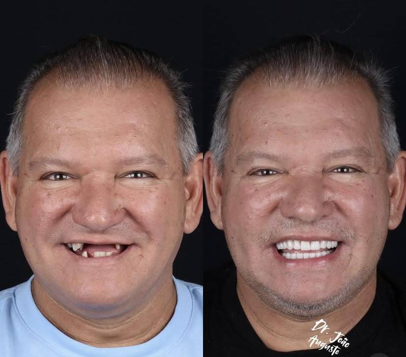 Referência em Odontologia e Harmonização: O casal de especialistas que está transformando sorrisos e vidas