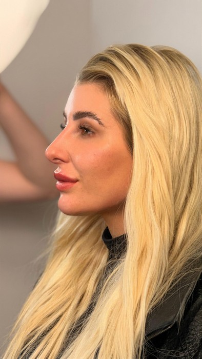 Desgaste público: Jéssica de Paula faz harmonização facial e mostra antes e depois
